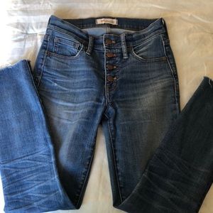 Madewell Button Front High Rise Skinny Jeans